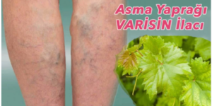 Varisin İla cı D’oğal Olarak Bulundu..