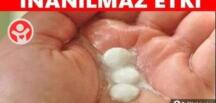 A’spirini eritip bacaklarınıza sürerseniz o Sorununuzu Hemen Geçiriyor.. T-A’RİFİ