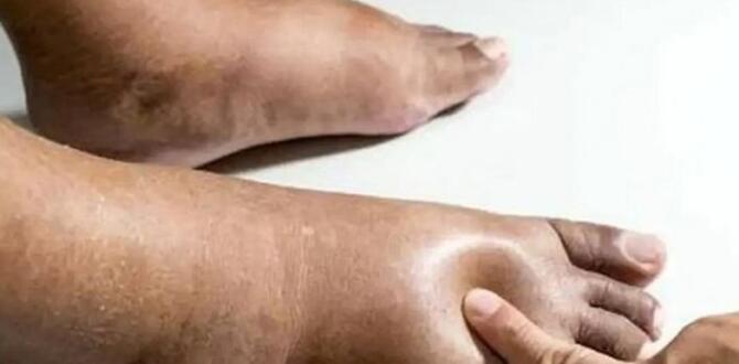 Ayak Bacak Şişmesi Ba’kın Neyin Belirtisi
