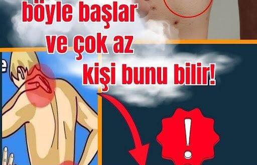 Bu belirtilere d!kkat! K-a’nser ilk olarak böyle belirtiler veriyor.