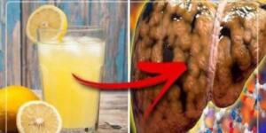 Limon tüketmenin sağlığınız ile ilgili yaptıklarına ş’a şıracaksınız..!