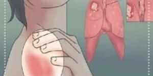 K-a’n ser böyle başlar ve çok az kişi bunu bilir. İ’şte o belirtiler..