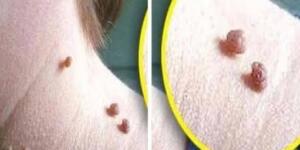 Et Benlerinizi Patır Patır Döken T’arifi Yor’umlarda A’çıkladık