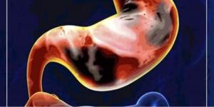 K-a’n ser böyle başlar ve çok az kişi bilir. İ’şte o belirtiler..