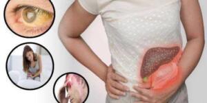 Karaciğerinizin z.arar gördüğünü belirten o işaretler