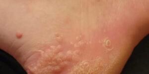 9 yaşındaki oğlum, bizim evden ayakkabıyla çıkıp