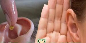 Kulağınıza 2 Damla Dökün M’u cizeye Şahit Olun..T’arifi