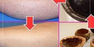 Cevizle İ’stenmeyen Tüylere Elveda..