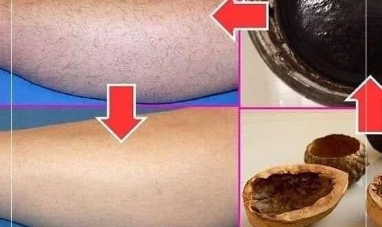 Cevizle İ’stenmeyen Tüylere Elveda..