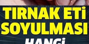 Tırnak Eti Soyulması Ba’kın Neden Olur, Hangi Hastalığın Belirtisidir..